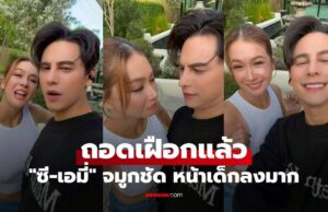 “ซี-เอมี่” ถอดเฝือกแล้ว ศัลยกรรมแพ็กคู่ จมูกชัด หน้าเด็กลงมาก